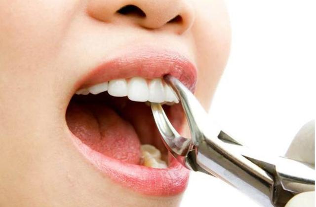 龅牙一般能收几毫米?内收3mm,4mm,5mm能改善嘴突吗